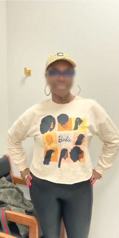 After medical weight loss, Sharon W., full length